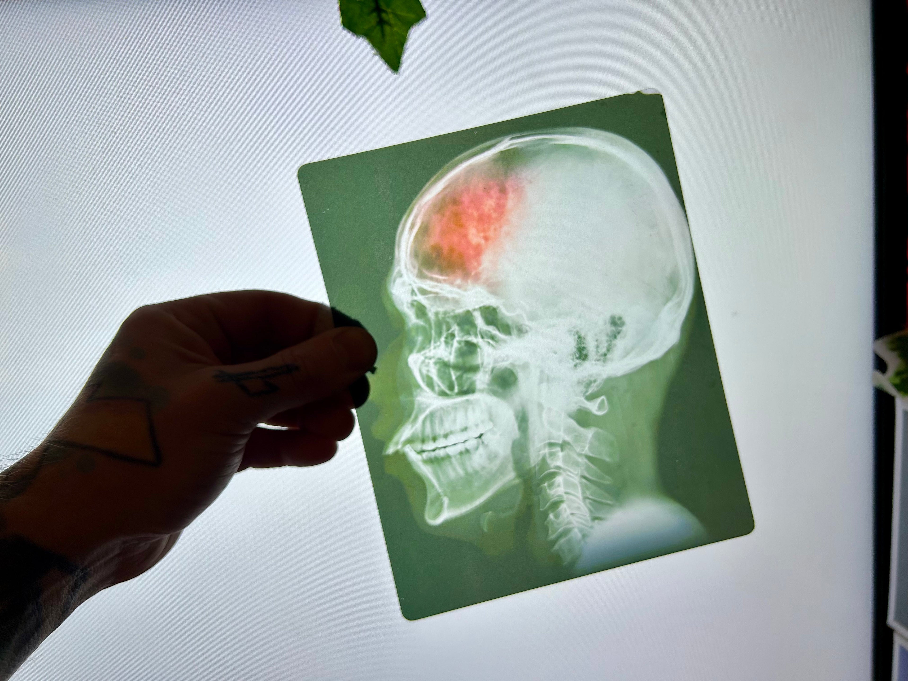 Infected Brain Scan Prop