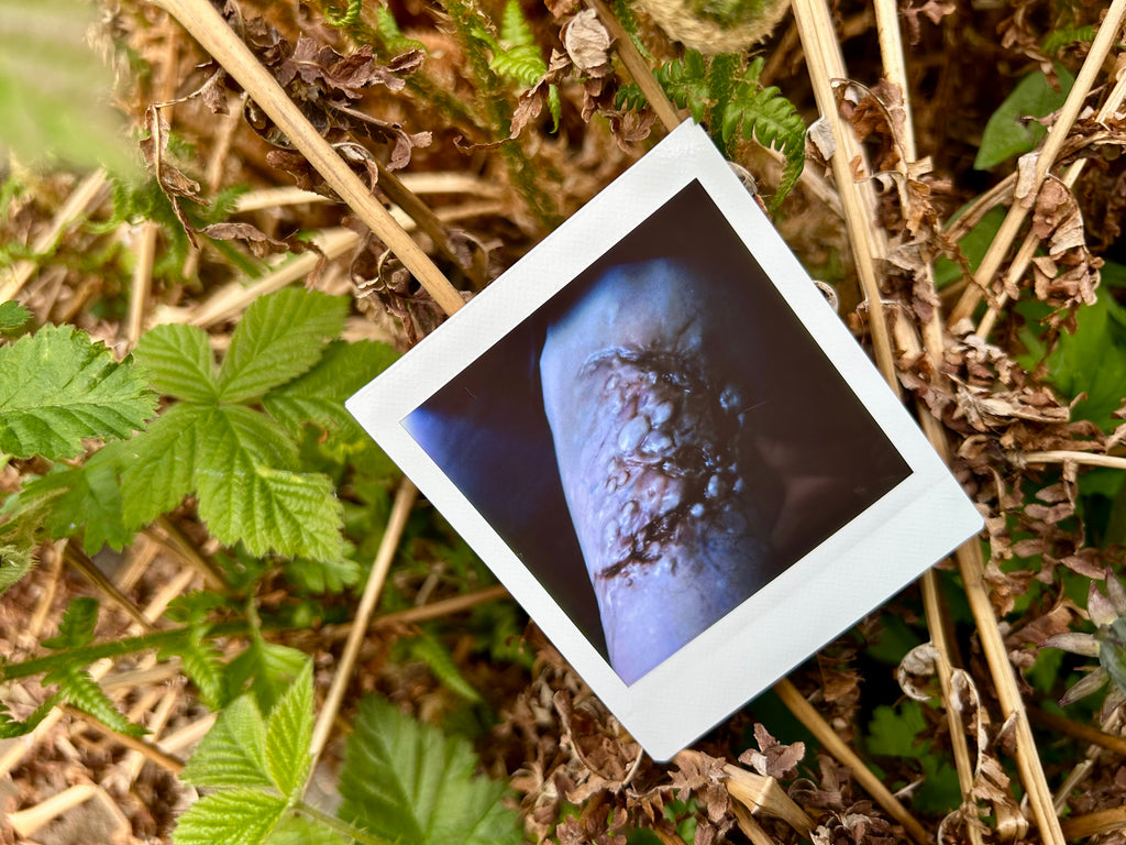 “I Can’t Get Infected” - Polaroid