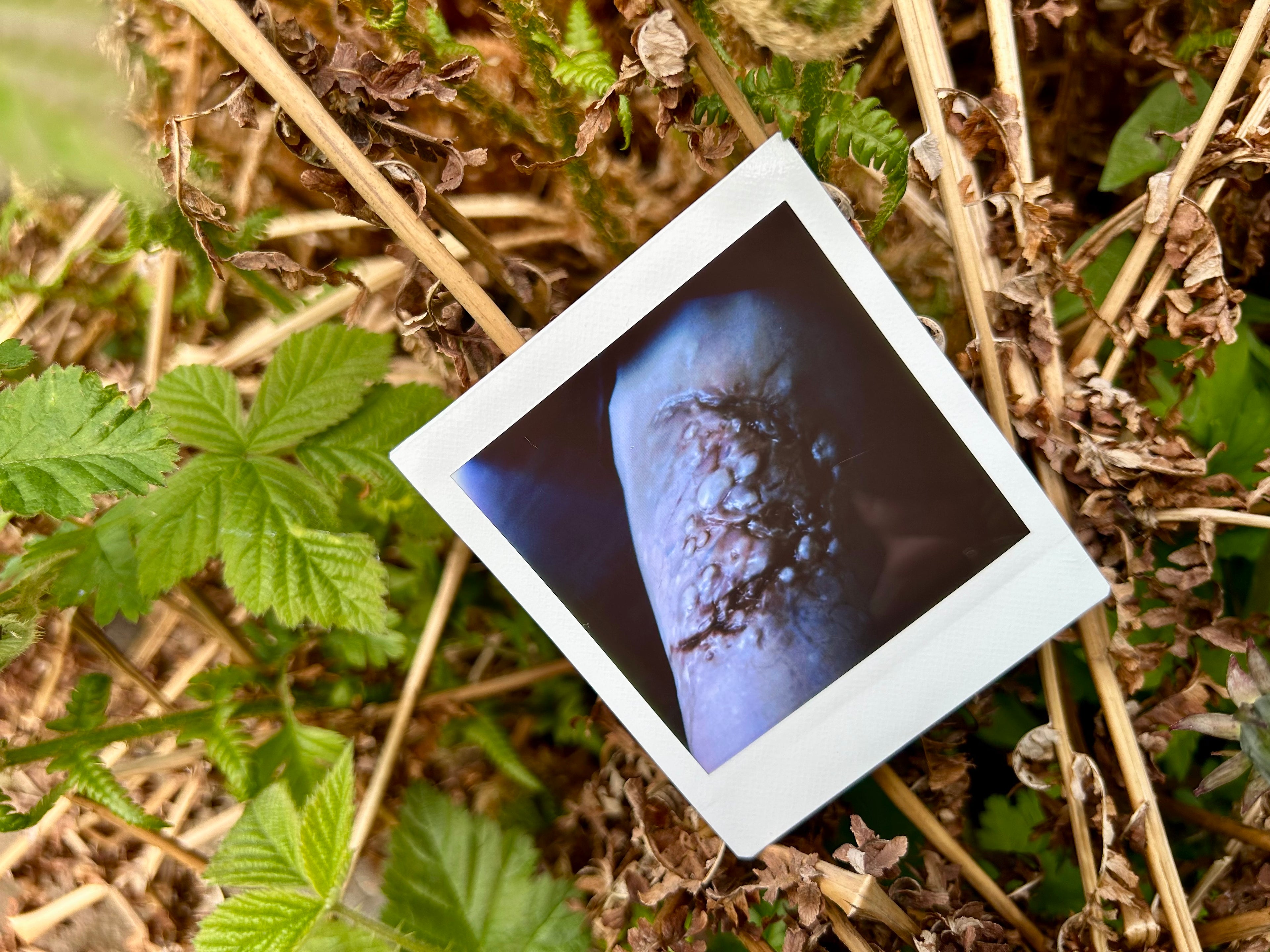 “I Can’t Get Infected” - Polaroid