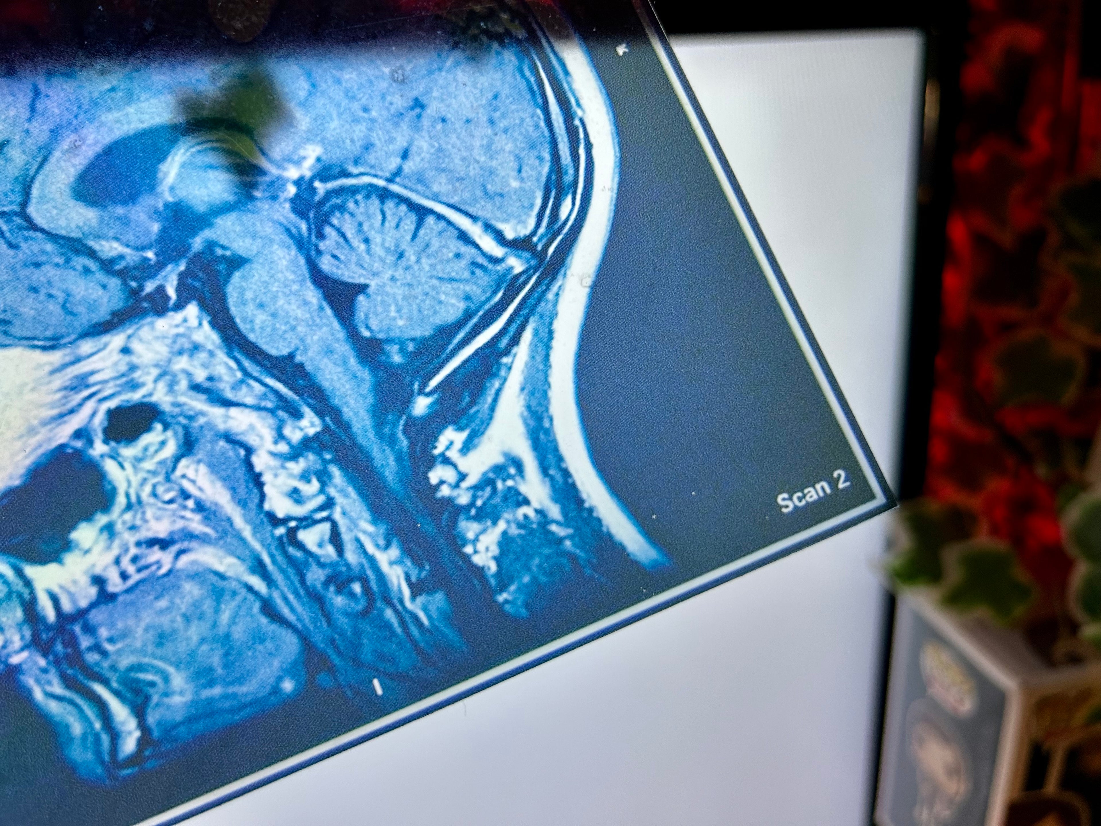 Brain Scan Props