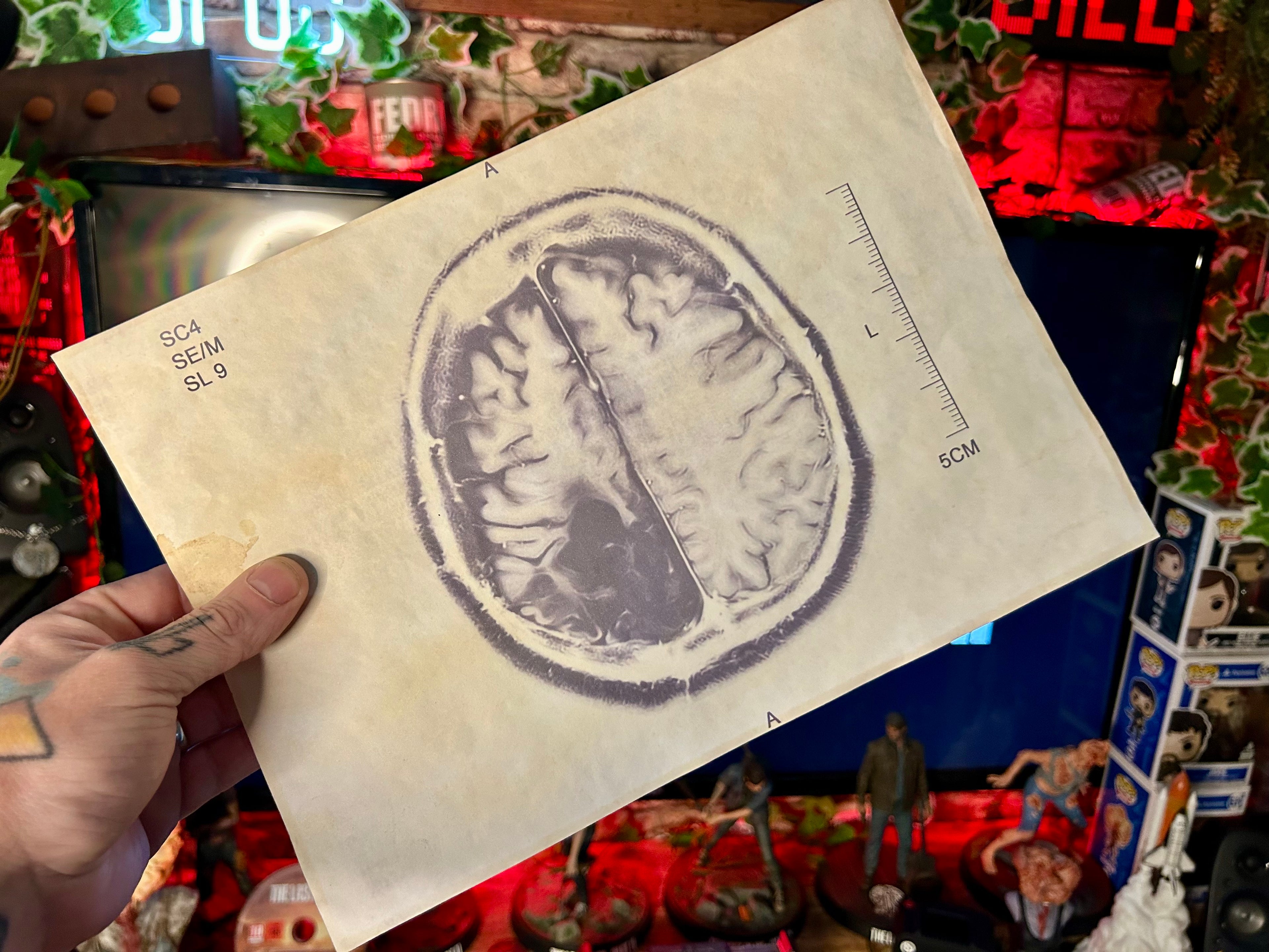 Infected Brain Scans - Posters