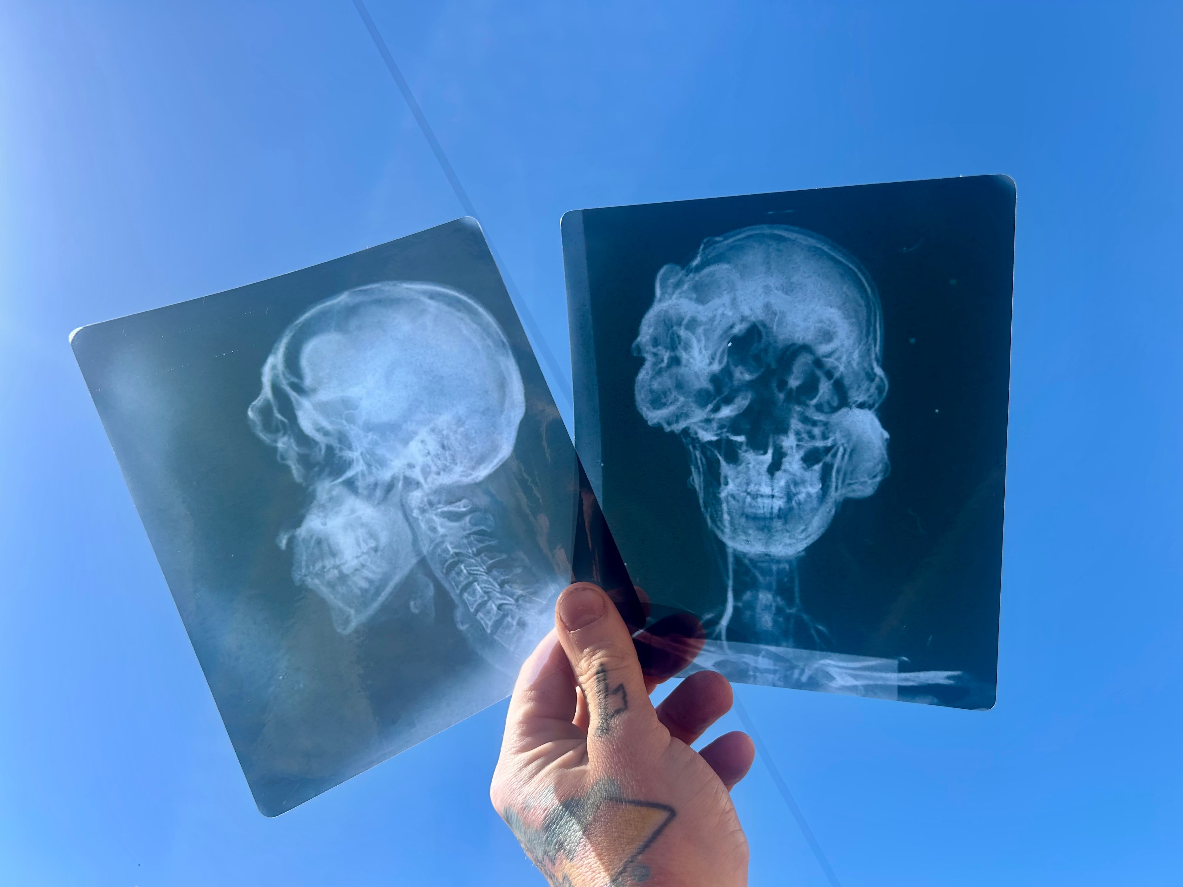 Infected X-Ray Props