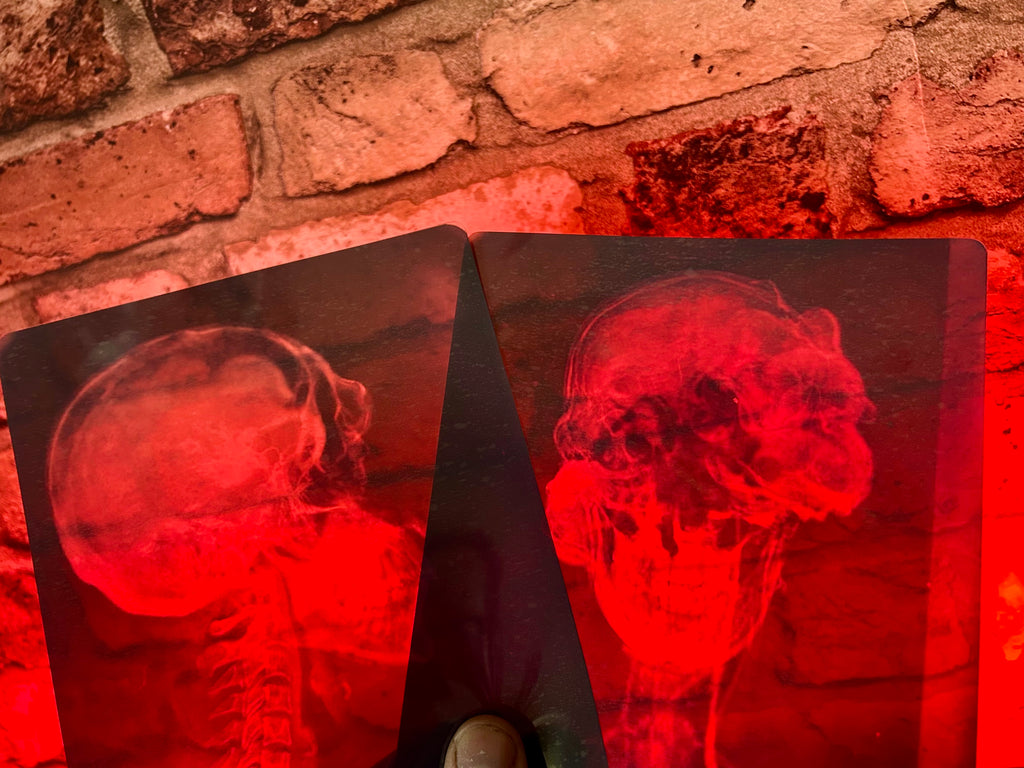 Infected X-Ray Props