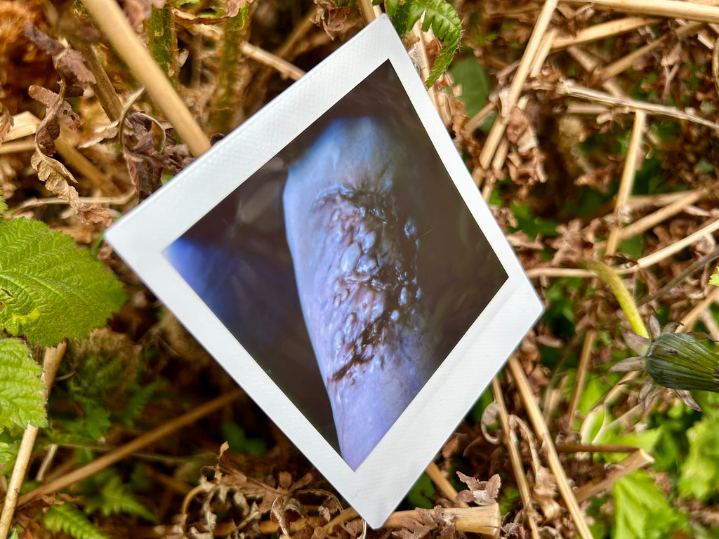 “I Can’t Get Infected” - Polaroid