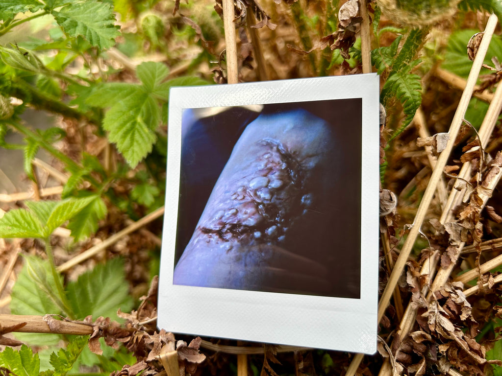 “I Can’t Get Infected” - Polaroid
