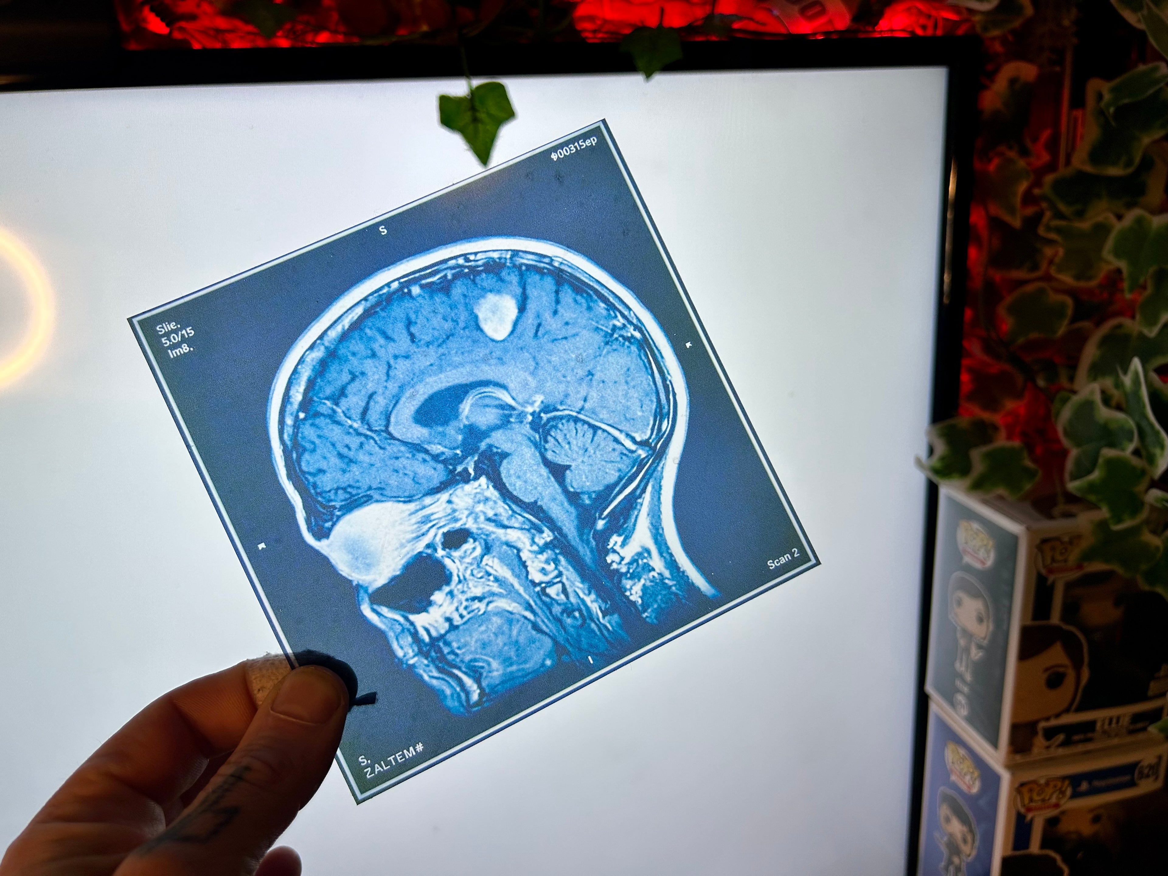 Brain Scan Props