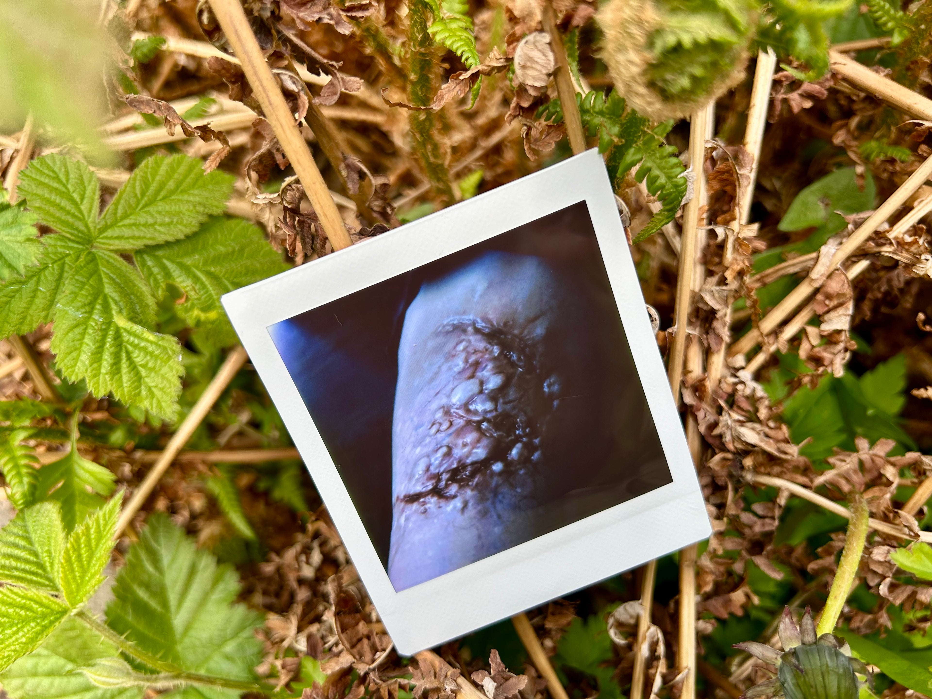 “I Can’t Get Infected” - Polaroid