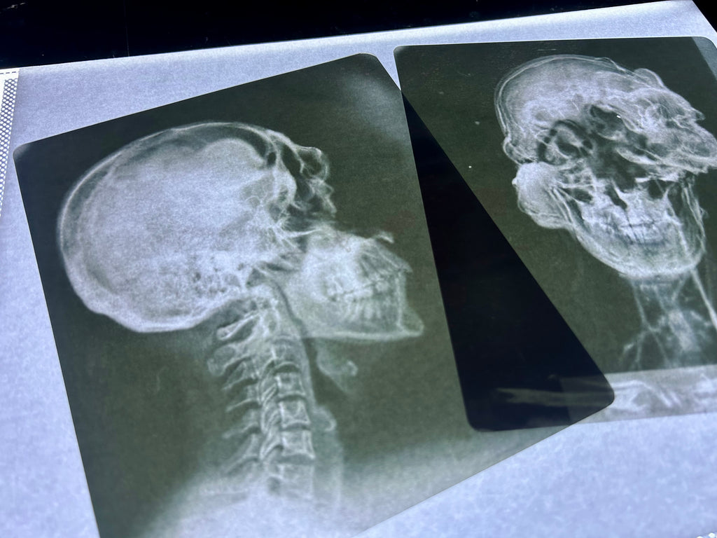Infected X-Ray Props