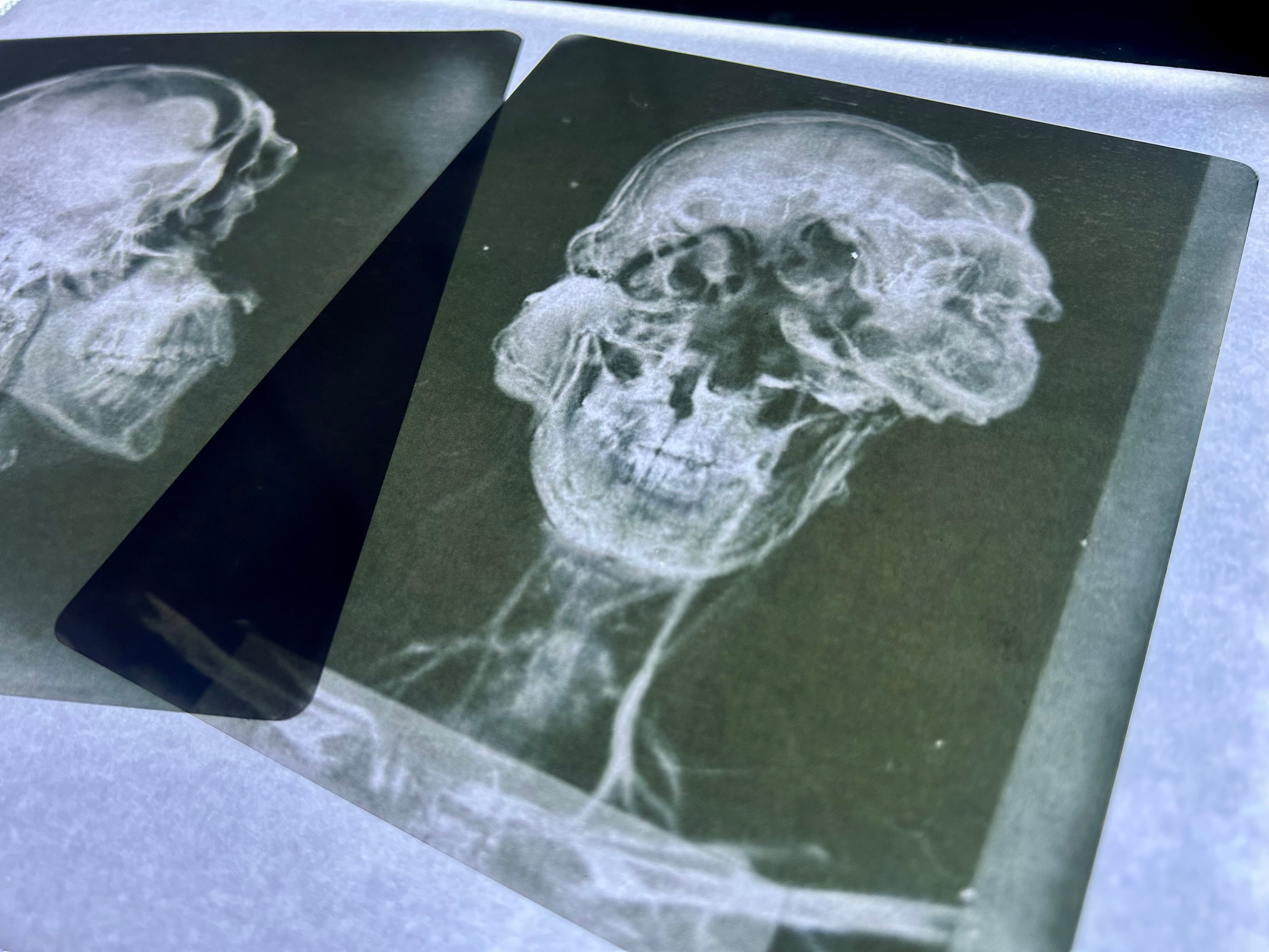 Infected X-Ray Props