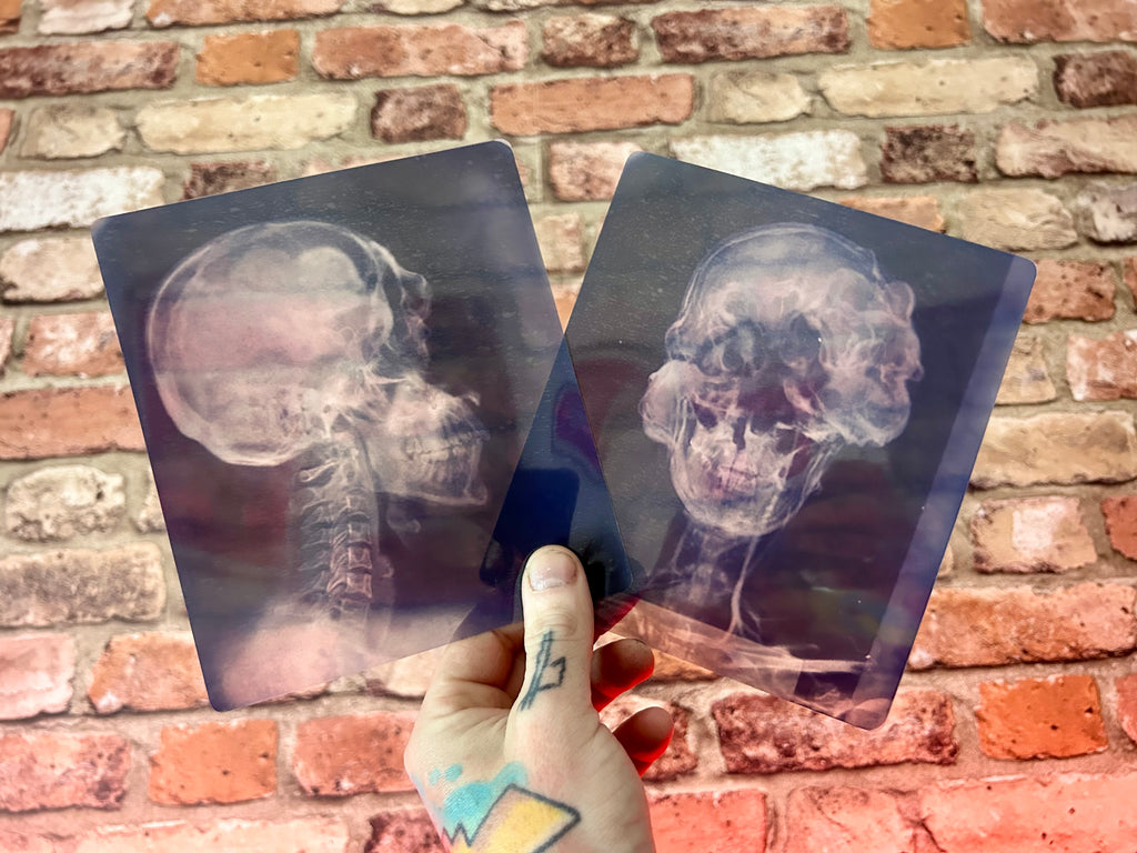Infected X-Ray Props