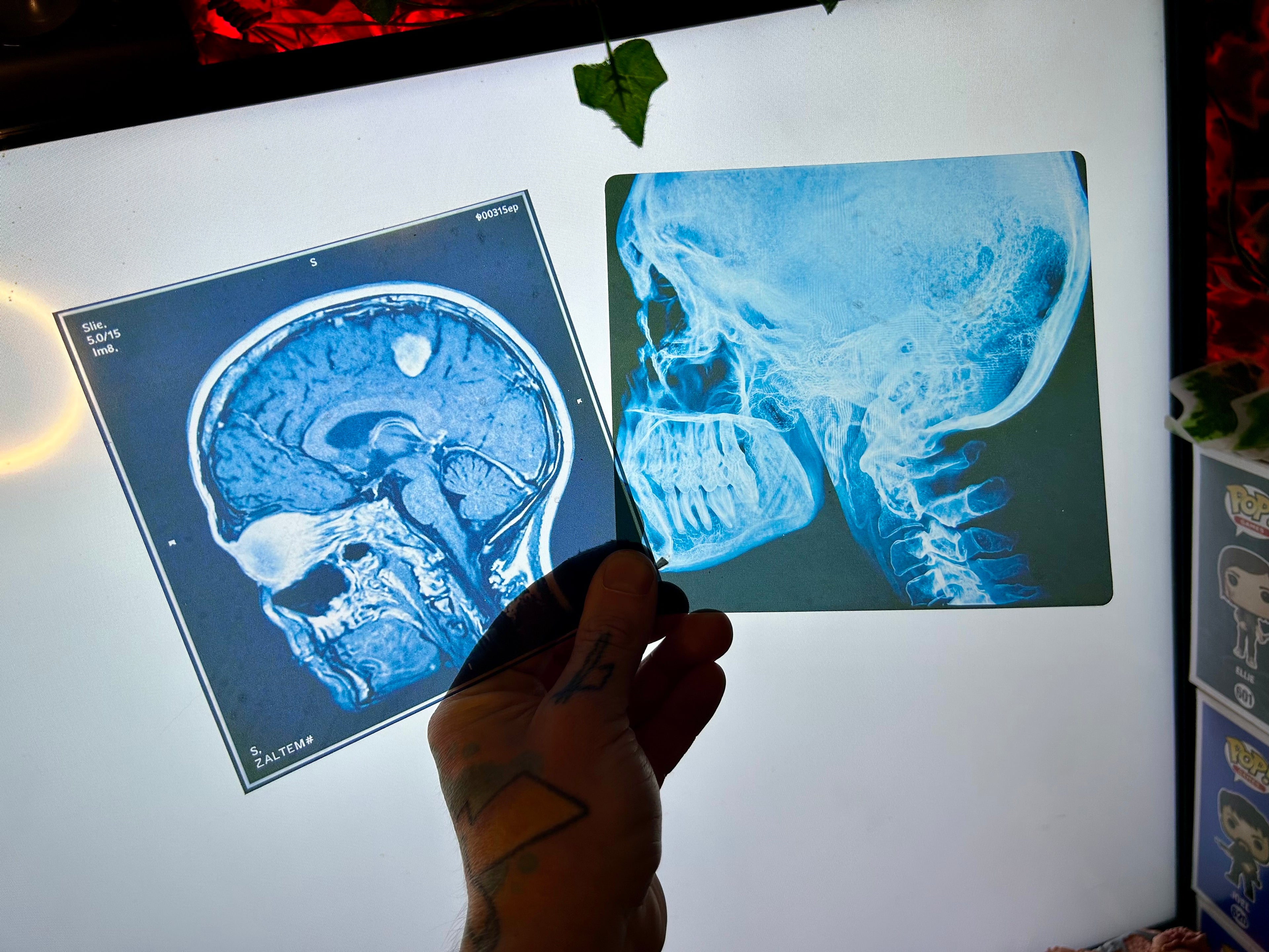 Brain Scan Props