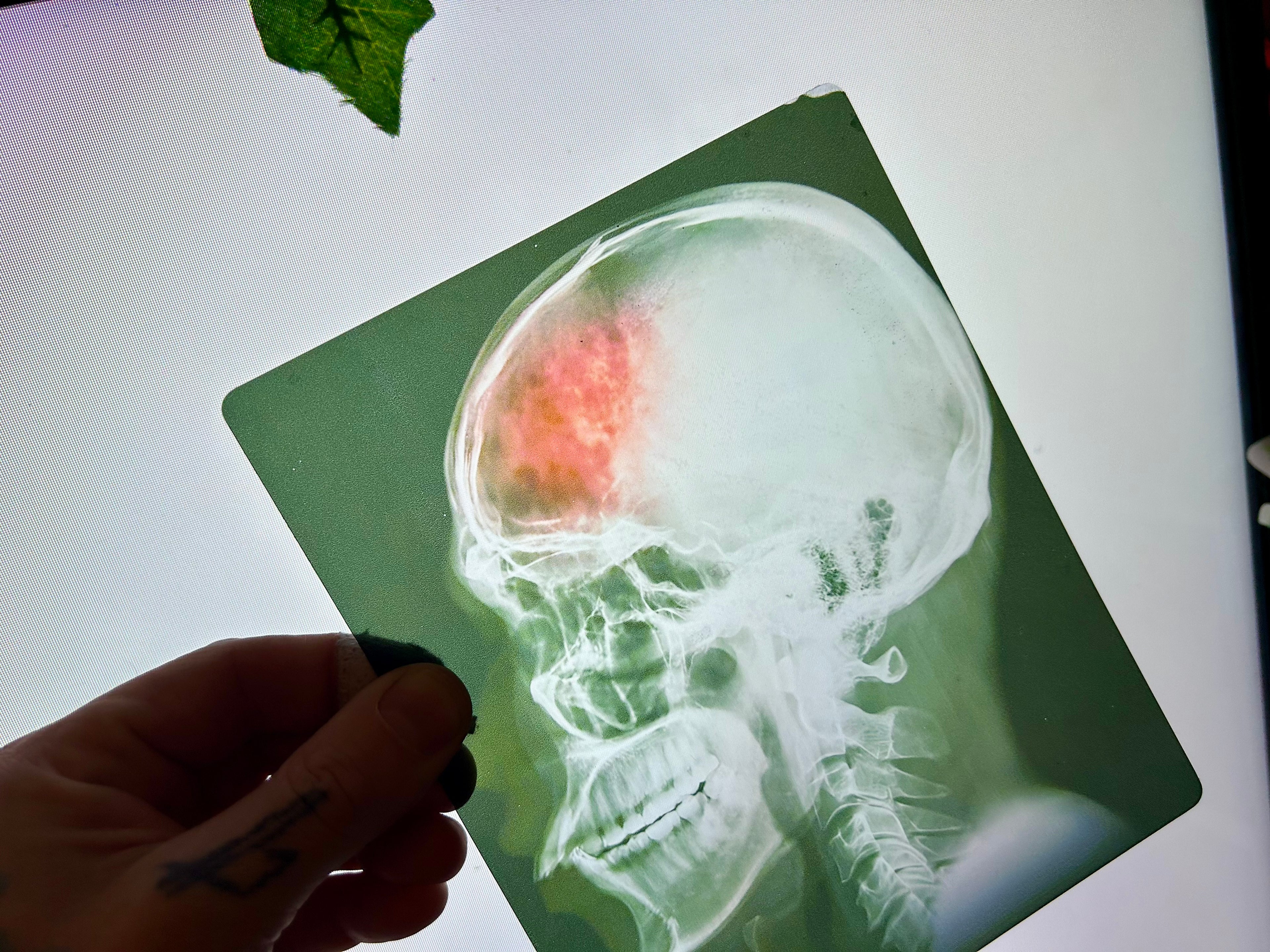 Infected Brain Scan Prop