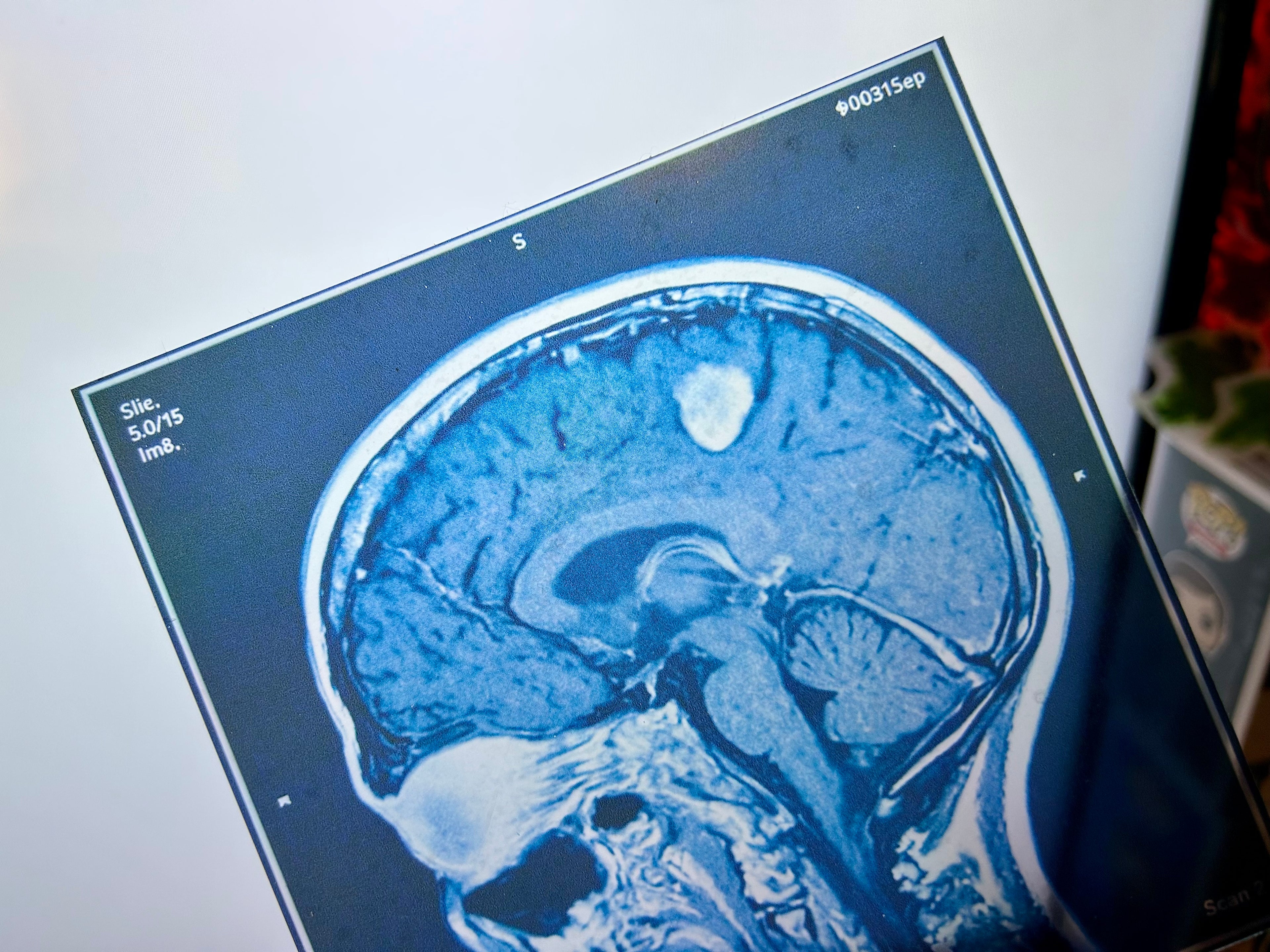 Brain Scan Props