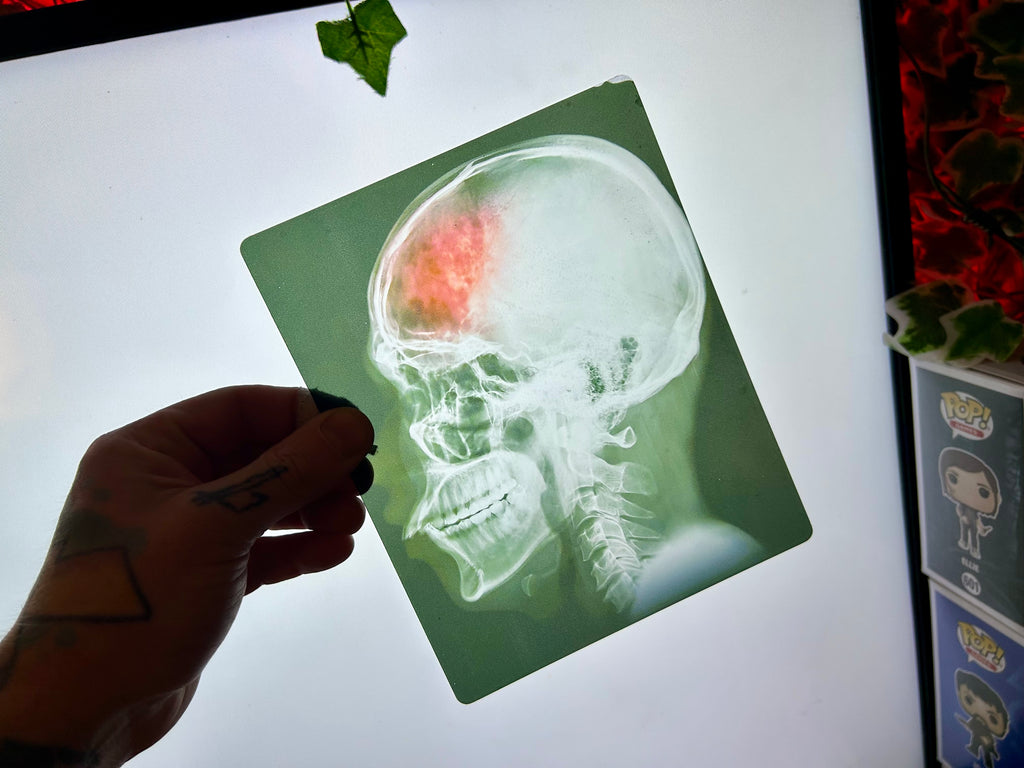 Infected Brain Scan Prop